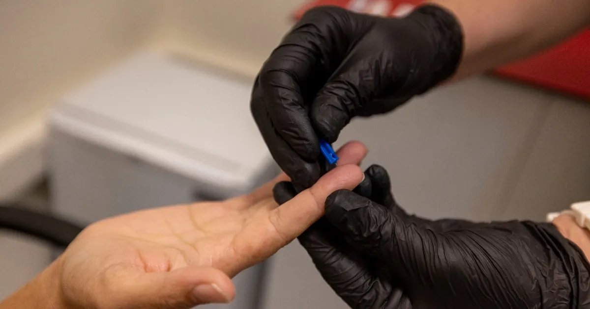 İzmir Büyükşehir’den kimliksiz ve ücretsiz test hizmeti