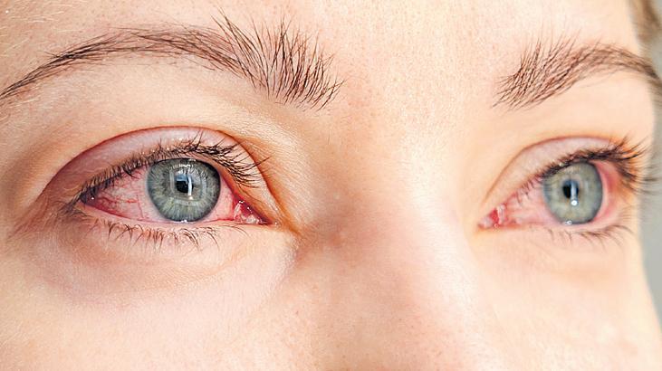 Diyabet gözlerinizi sessizce tehdit ediyor