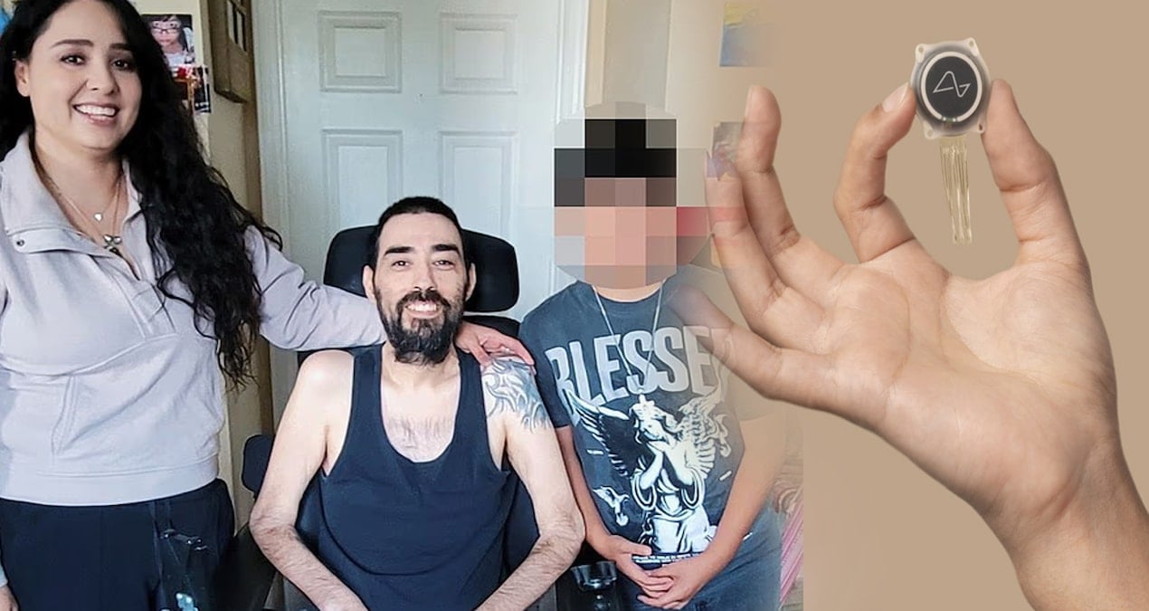 Elon Musk’un deney yaptığı insanlar ortadan kayboldu: Gerçekler ortaya çıktı